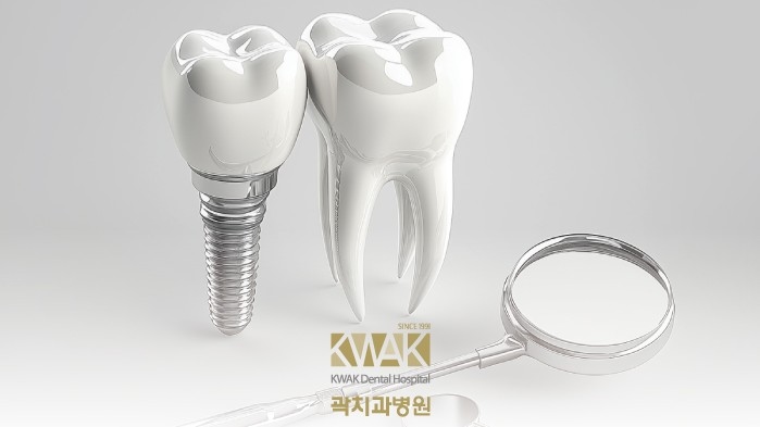 성당동치과 보험 임플란트, 비용은 같아도 결과는 다를 수 있습니다.